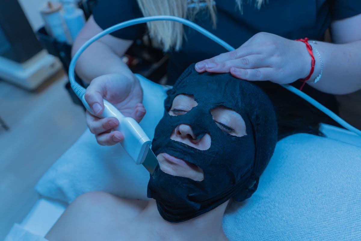 Carbon Peel