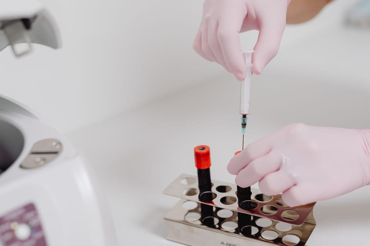 Exosome Therapy
