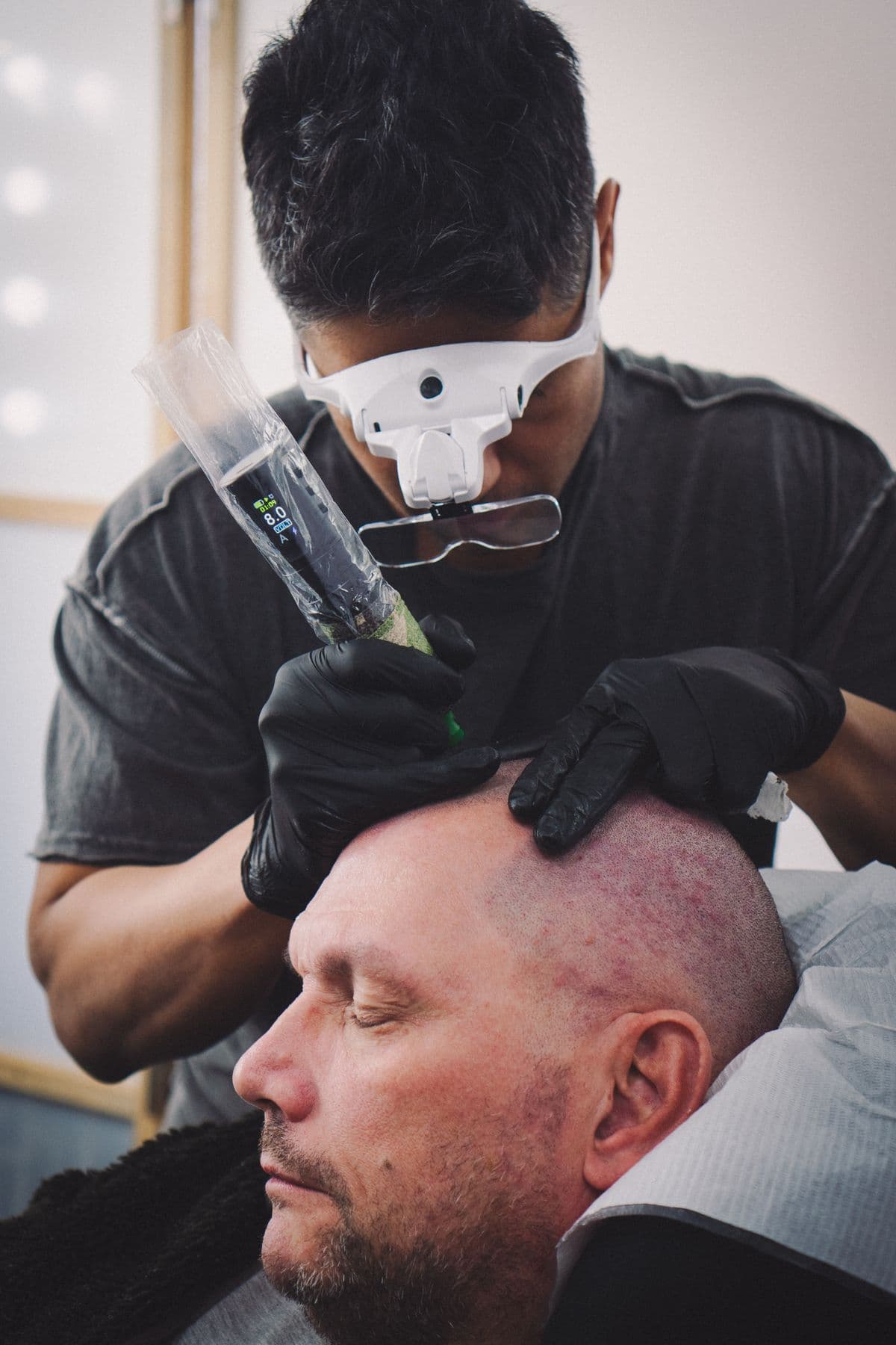 Scalp Microblading