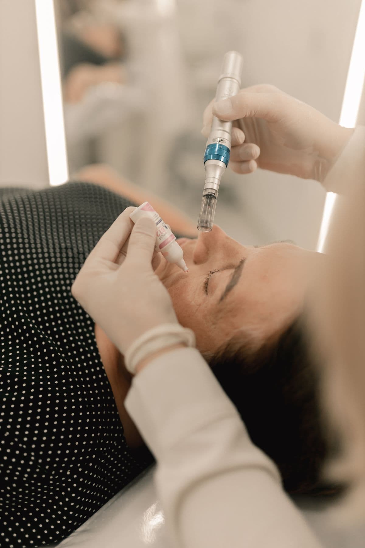 MNRF (Microneedling with Radiofrequency)